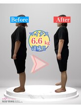 みらい整体院 東根院/Before After