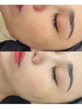 ユミサロン(U Mi Salon)/ハーブで肌にうるおいをチャージ