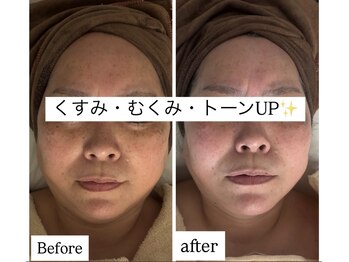 ソルツーサロン マナ(MANA)/40代からの肌革命★