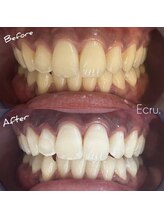 エクリュ(Ecru)/Before→After