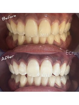 エクリュ(Ecru)/Before→After