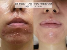 サロンドリー(salon de Re)/