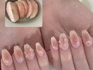 チックネイル
