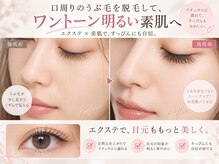 アキュート エの雰囲気（［脱毛/フェイシャル/LED/マツエク/毛穴/毛穴ケア］）