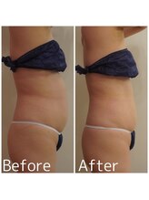 トータルビューティサロン クイーン(Queen)/40代以降の女性の痩身