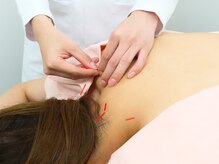 ハンドワーク(HANDWORK)/首肩の施術