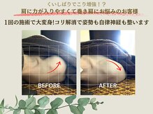 ヤーチャイスパ(yachai spa)の雰囲気（本気で頭痛を改善したい方は諦める前にご相談下さい！巻き肩も◎）