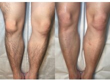 エヴァワックス 大阪 南堀江店(Eva Wax)/脱毛/ブラジリアンワックス