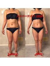 美彩8 びさいや/お腹の脂肪も燃焼☆即日体感！