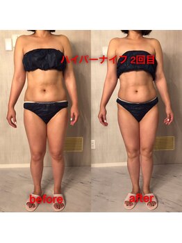 美彩8 びさいや/お腹の脂肪も燃焼☆即日体感！