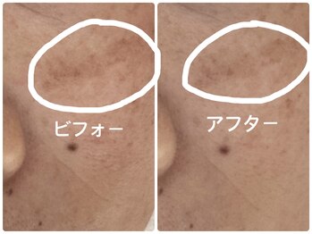 ノーブル シャット Noble Chate/シワもシミもたるみも気になる方