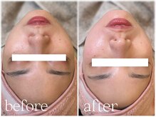 リベル ビー(ReBell Bee)/フルフェイスワックス