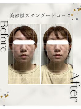 サロン ド ハリッシュ(Salon de HARISH)/フェイスラインに