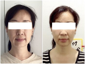 美容整体 ウェリナ 蟹江院/小顔矯正/骨盤矯正/痩身整体