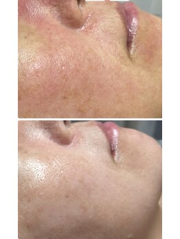 チュチュ(TUTU)/根本肌質改善