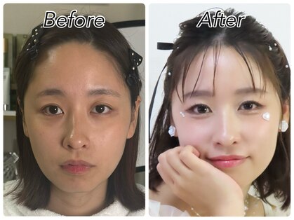 ハッピーアリスター(HAPPY ALISTER)の写真