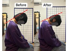 整体院 爽良/【札幌/大通り】首痛に特化