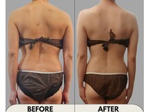 プラスイー(+e)/お悩みの肩首コリの改善したら！