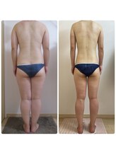 加圧ビューティーサロン スタイル エム(beauty salon style M)/30代/加圧×パワーツリー120分
