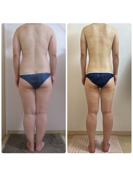 加圧ビューティーサロン スタイル エム(beauty salon style M)/30代/加圧×パワーツリー120分