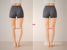 ベアフット(BARE FOOT)/顔だけじゃない