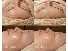ソアム(Soame)の雰囲気（シワ・毛穴・くすみ・ハリ不足に◎1回の施術でも効果を実感！）