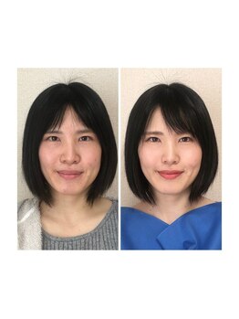 エマーブル(Emarble)/ブルベ冬のお客様