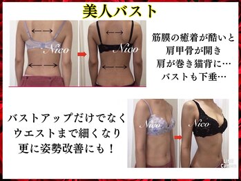 ニコ 岐南本店(Nico)/バスト★before→after