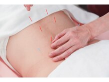 美容鍼灸salonまつもと/