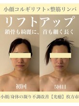 光癒(コウユ)/Before.After