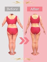 ピュアエステブリアント 銀座店 40代 痩身結果