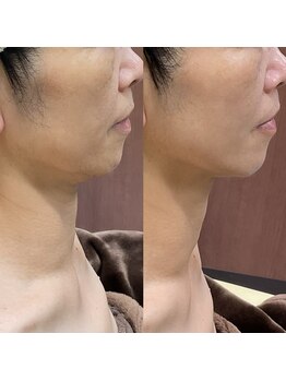 メイス 福井店(MEIS)/お客様Before、After