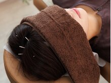 オリーブ鍼灸院/頭皮の鍼