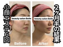 ベル 南船場店(Belle)の雰囲気（少ない回数で小顔者続出!卒業最短エステ!同時に肌管理メニュー◎）