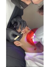 【脱毛・セルフホワイトニング】男性も女性も◎自己処理よりプロに任せる身だしなみで清潔感UP