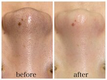 アリエス/ハイドラの効果