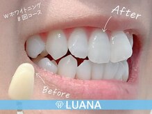 ルアナ(LUANA)の雰囲気(セルフホワイトニング初回¥2300)