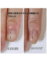 ネイルハウス ハピネス(HAPPINESS)/育成ネイルケア