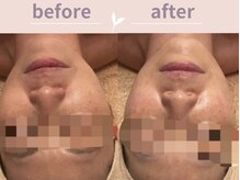 アール(R)/選べるパックコース♪