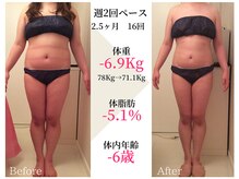 ベルタ 仙台店(BELTA)/【ケア前→後】5ヶ月で-6.9キロ
