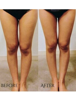 ユニ(uni.)/パワーレメディ造形×筋膜剥