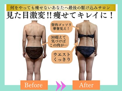 ヨサパーク ナンシー(YOSA PARK Nancy)の写真