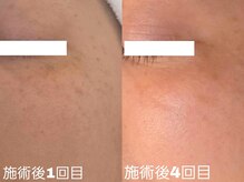 エクラリール(eclat rire)の雰囲気（≪最新機器導入/6枚のフィルターを使い分け高濃度美容液導入》）
