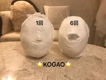 コガオ(KOGAO)/【効果実感】石膏パック×小顔