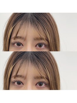 MBL バイ ルシュカ(MBL by LUSHCA)/ラッシュリフト★彡