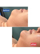 サロン ド メタセコイア(salon de Metasequoia)/フェイシャル