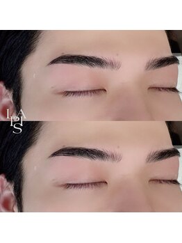 フレイズラピス(FRASE Lapis)/メンズハリウッドブロウリフト