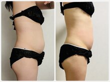 スリーエレメンツ(THREE ELEMENTS)/痩身/お腹まわりスッキリ◎