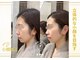 メリラ ザ ビューティー(MELILA THE BEAUTY)の写真