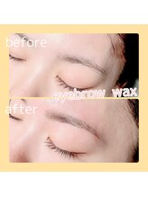 アイデュース acty店(eyeduce)/【before　after】